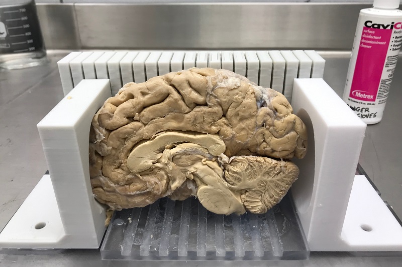 Brain Jig